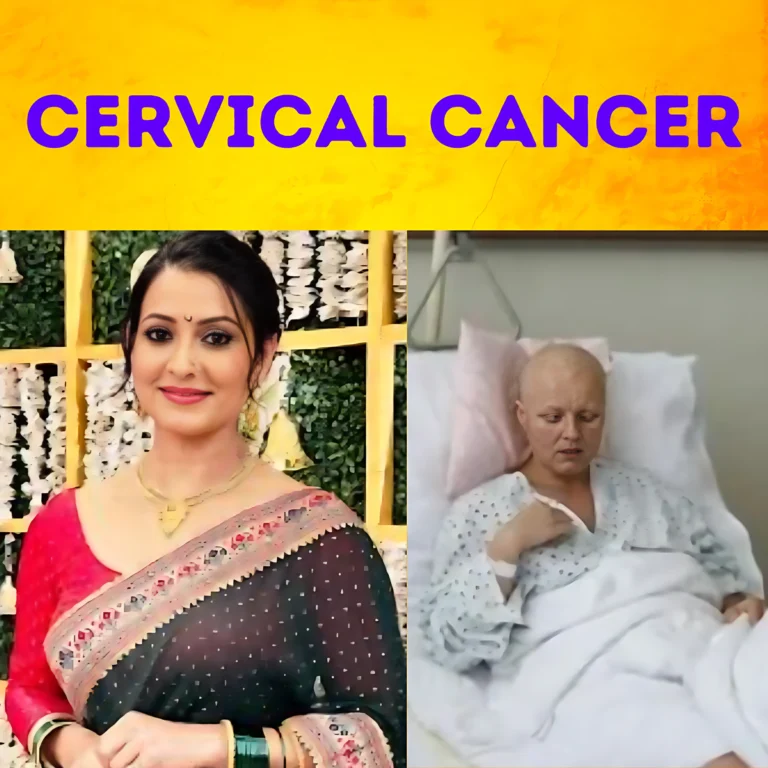 Actress Dolly Sohi Cervical Cancer